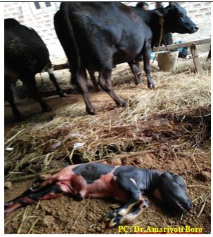 Abortion in late trimester
