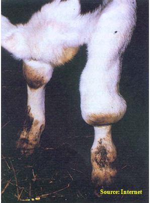 Hygroma knee swelling
