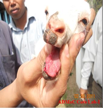 Ulcers on tongue and gums