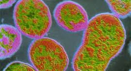 Brucellosis Image 1