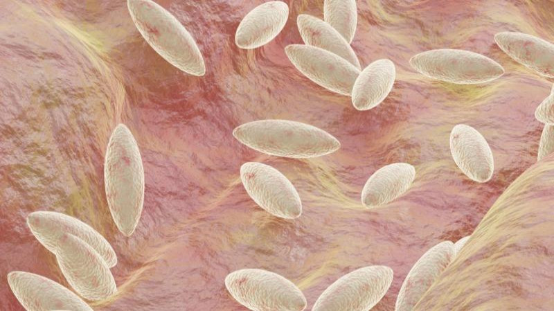 Brucellosis Image 3